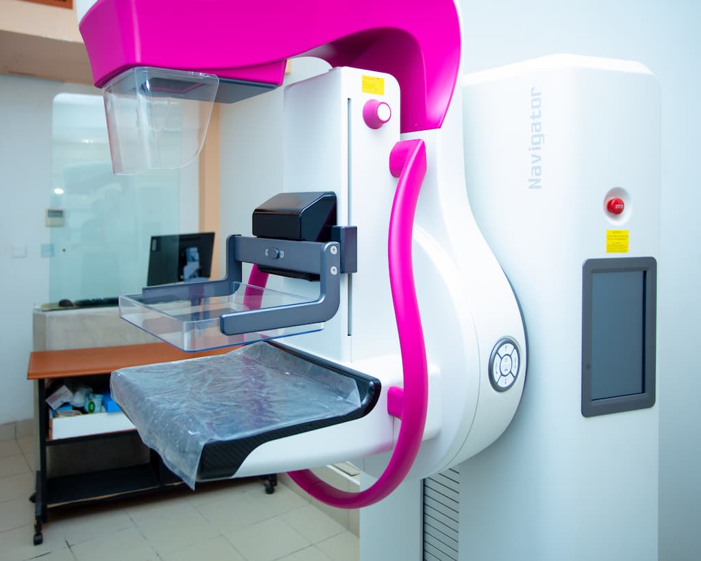 Digital Mammography